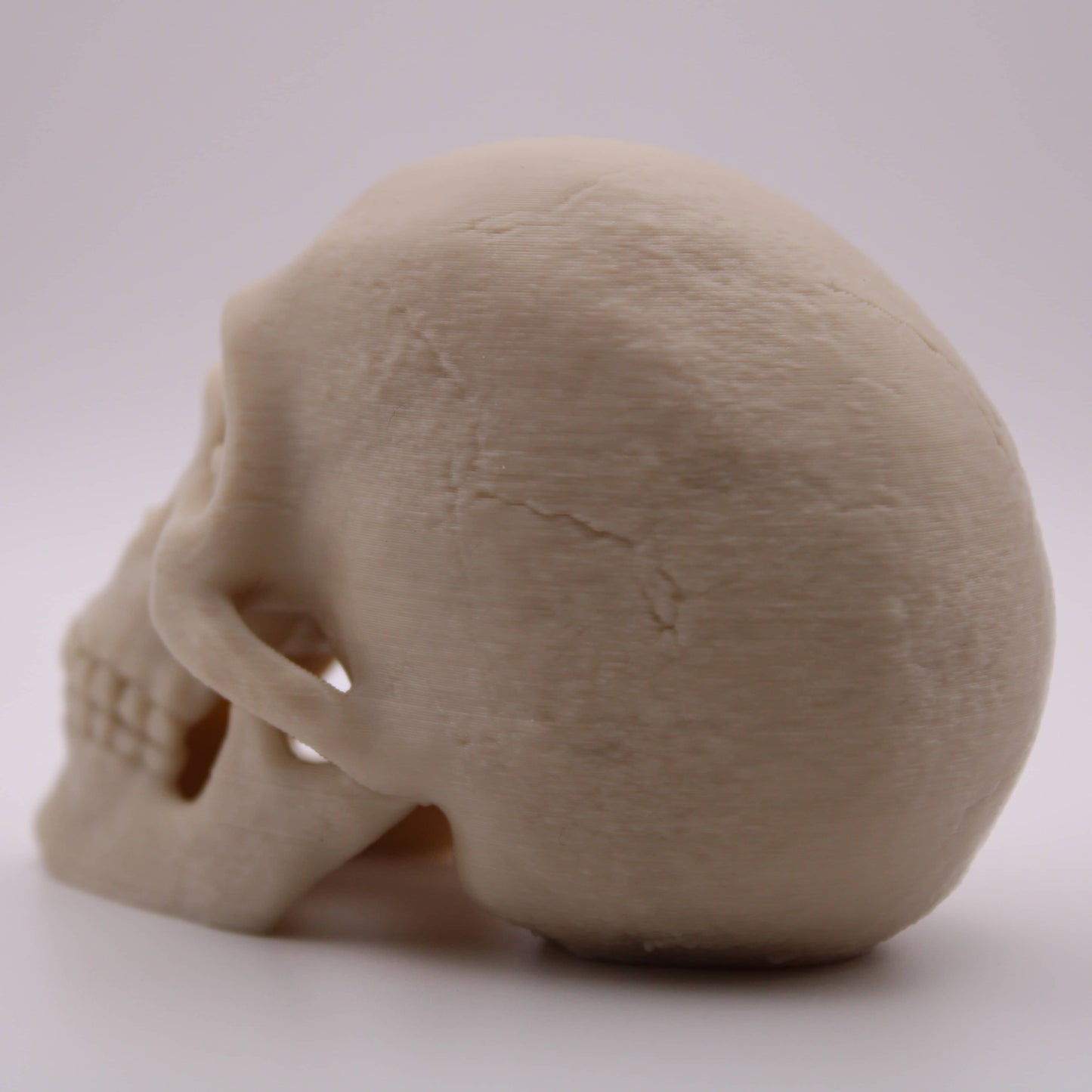 Corinthian Skull